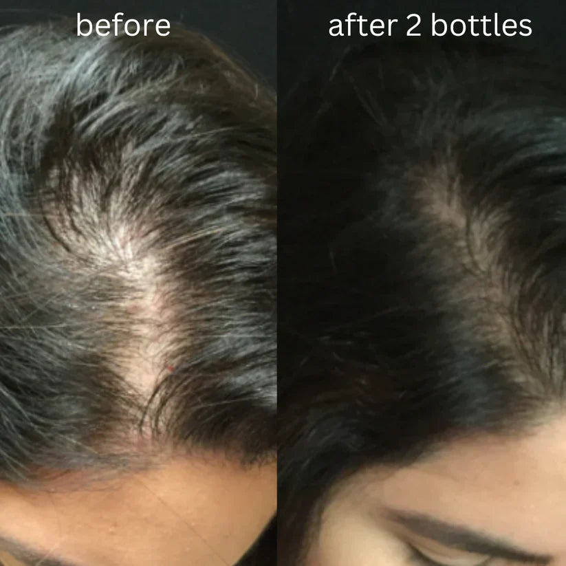 Parsa Organics Hair Oil + Shampoo (Buy Hair Oil Get Shampoo Free)